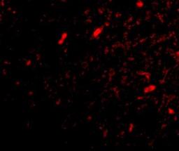 Immunocytochemistry/Immunofluorescence: FBXL20 Antibody [NBP1-77317] - Immunofluorescence of scrapper in human brain tissue with scrapper antibody at 20 ug/mL.