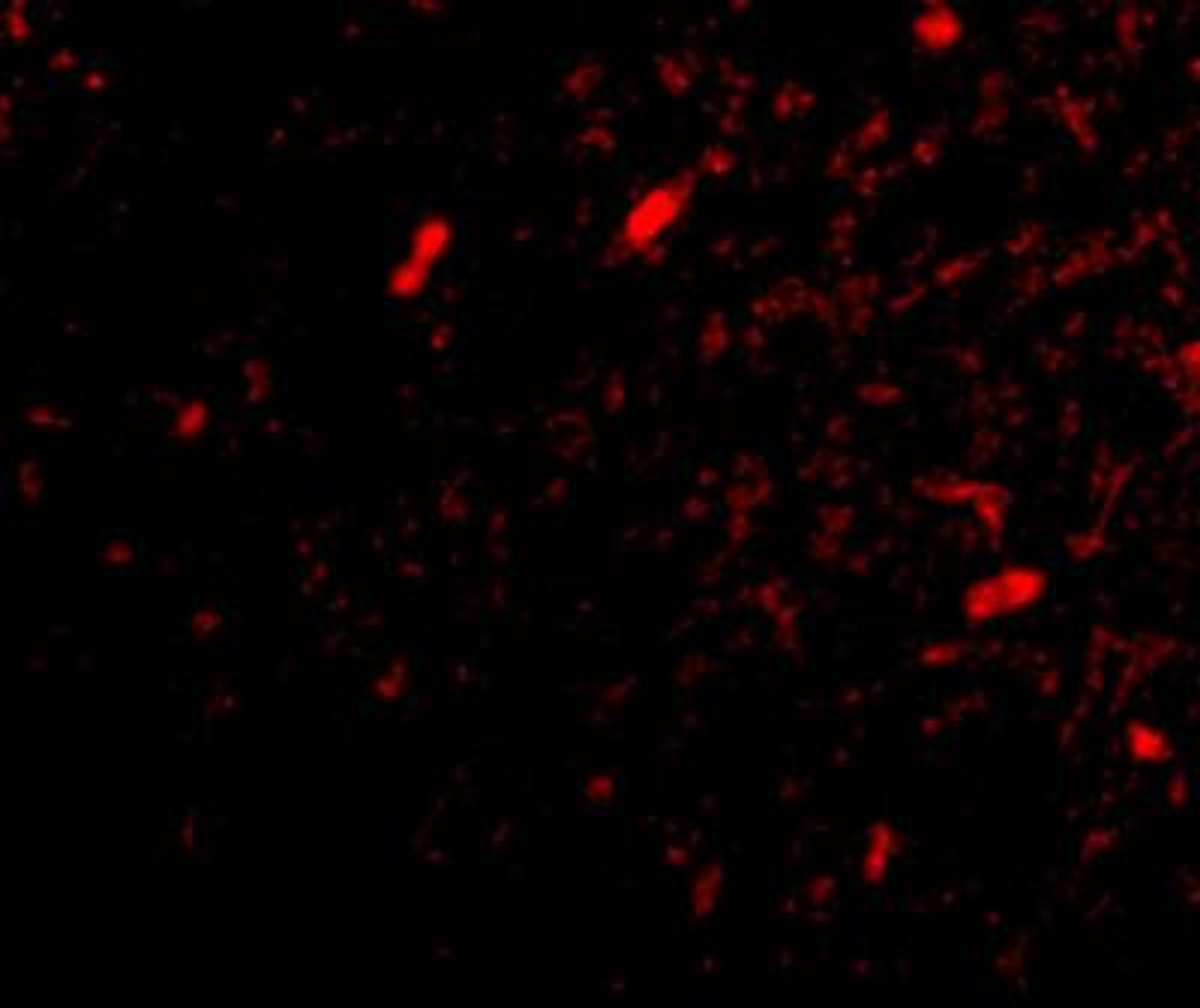 Immunocytochemistry/Immunofluorescence: FBXL20 Antibody [NBP1-77317] - Immunofluorescence of scrapper in human brain tissue with scrapper antibody at 20 ug/mL.