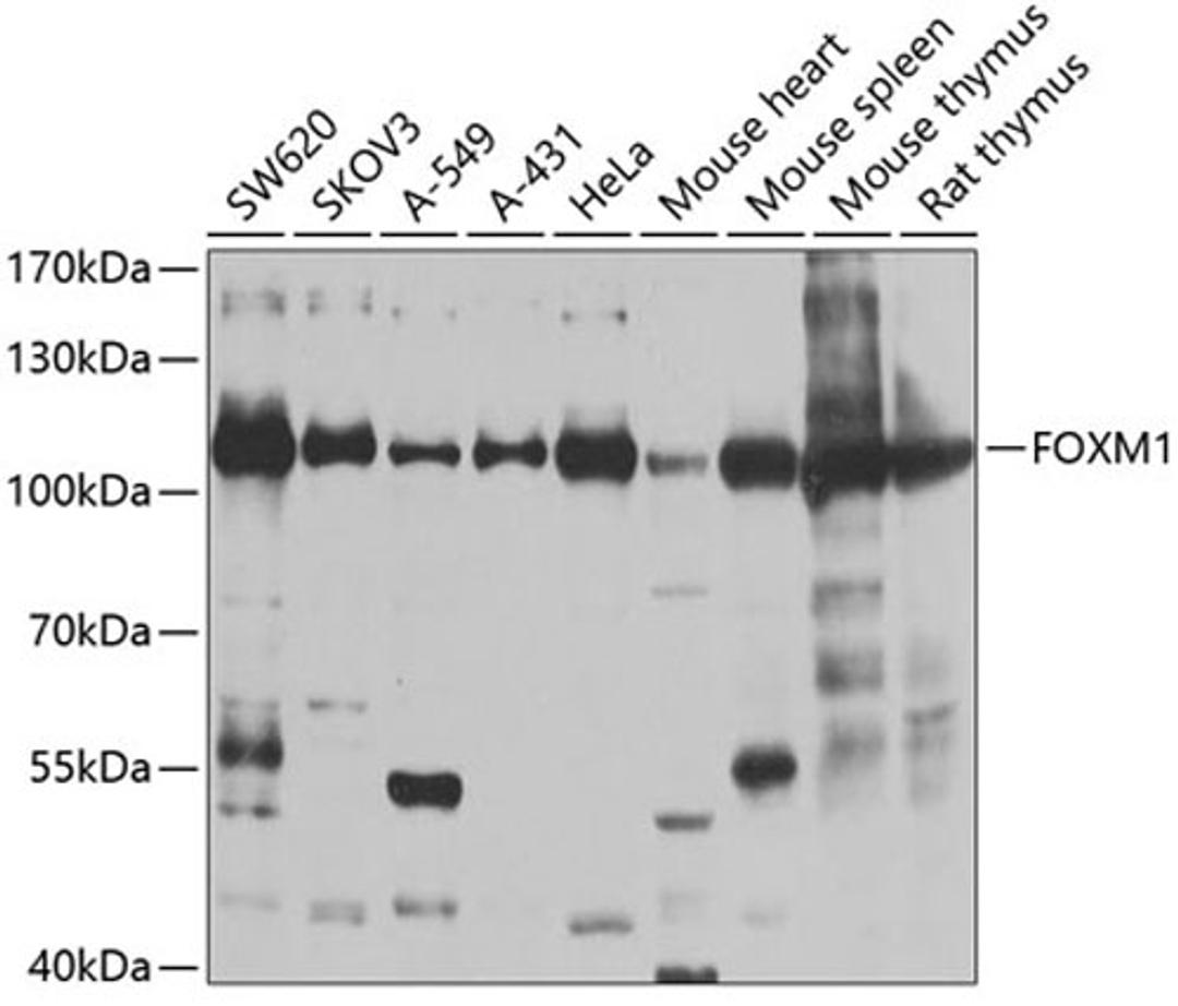 Western blot - FOXM1 antibody (A2493)