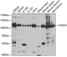 Western blot - FOXM1 antibody (A2493)