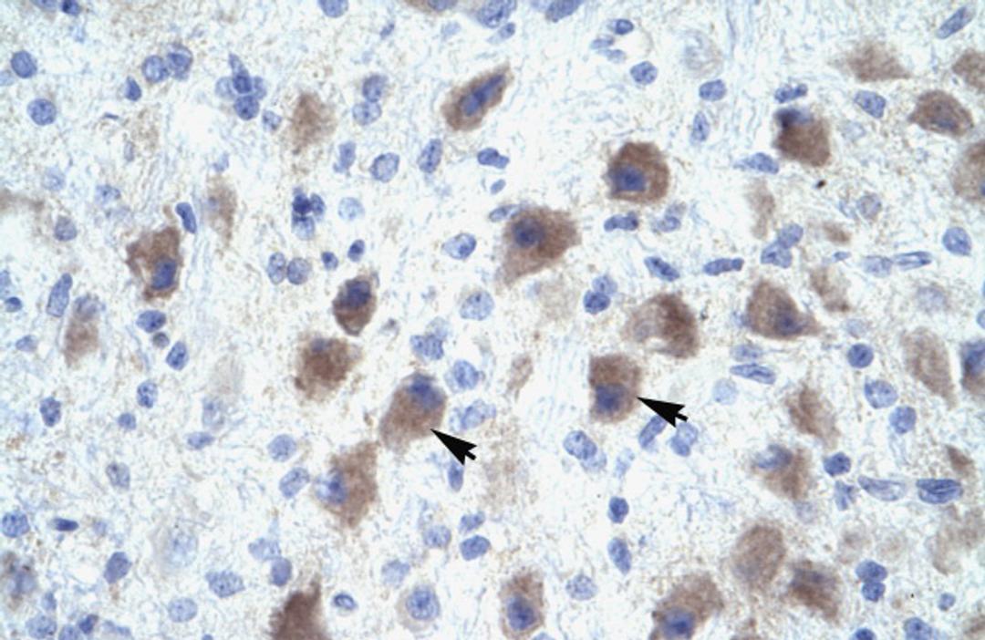 Antibody used in IHC on Human Brain at 4.0-8.0 ug/ml.