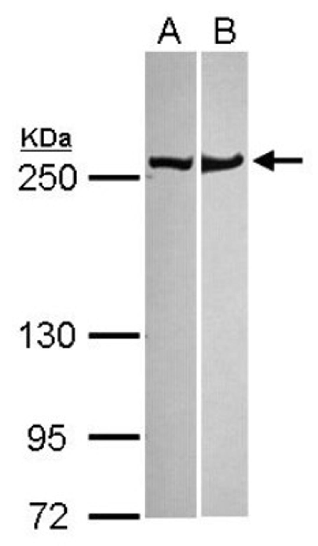 Western Blot: non-muscle Myosin IIA Antibody [NBP1-31733] - Sample (30 ug of whole cell lysate) A: NT2D1 B: MCF-7 5% SDS PAGE; antibody diluted at 1:1000.