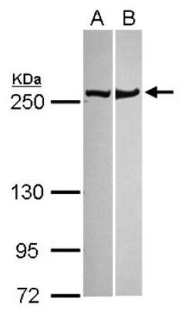 Western Blot: non-muscle Myosin IIA Antibody [NBP1-31733] - Sample (30 ug of whole cell lysate) A: NT2D1 B: MCF-7 5% SDS PAGE; antibody diluted at 1:1000.