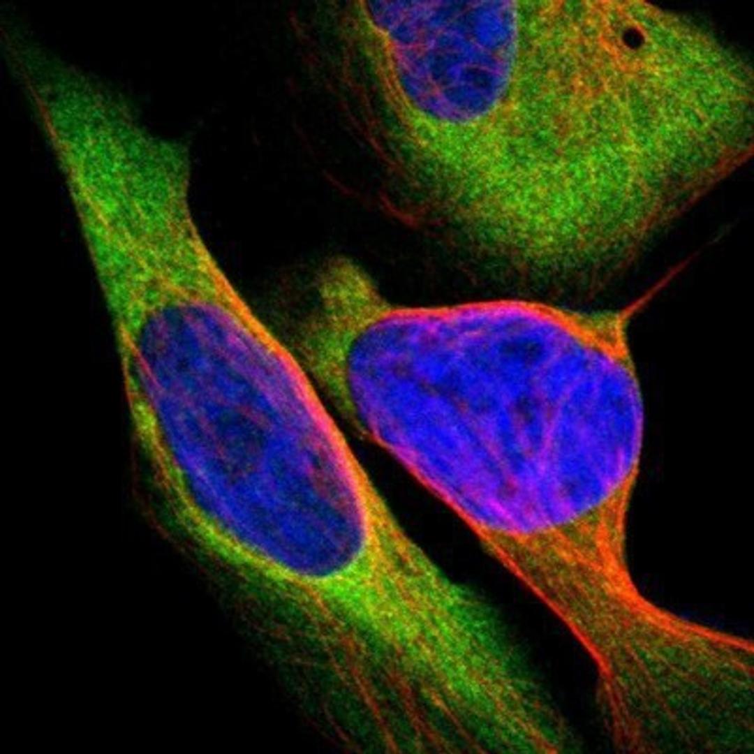 Immunocytochemistry/Immunofluorescence: CARS Antibody [NBP1-86624] - Staining of human cell line U-2 OS shows positivity in cytoplasm.