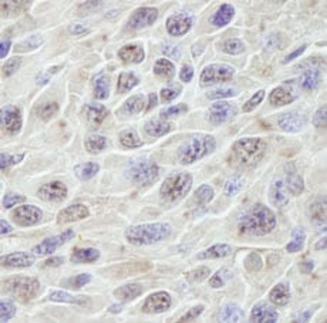 Detection of mouse PRKRIR by immunohistochemistry.