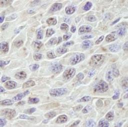 Detection of mouse PRKRIR by immunohistochemistry.