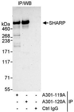 Detection of human SHARP by western blot of immunoprecipitates.