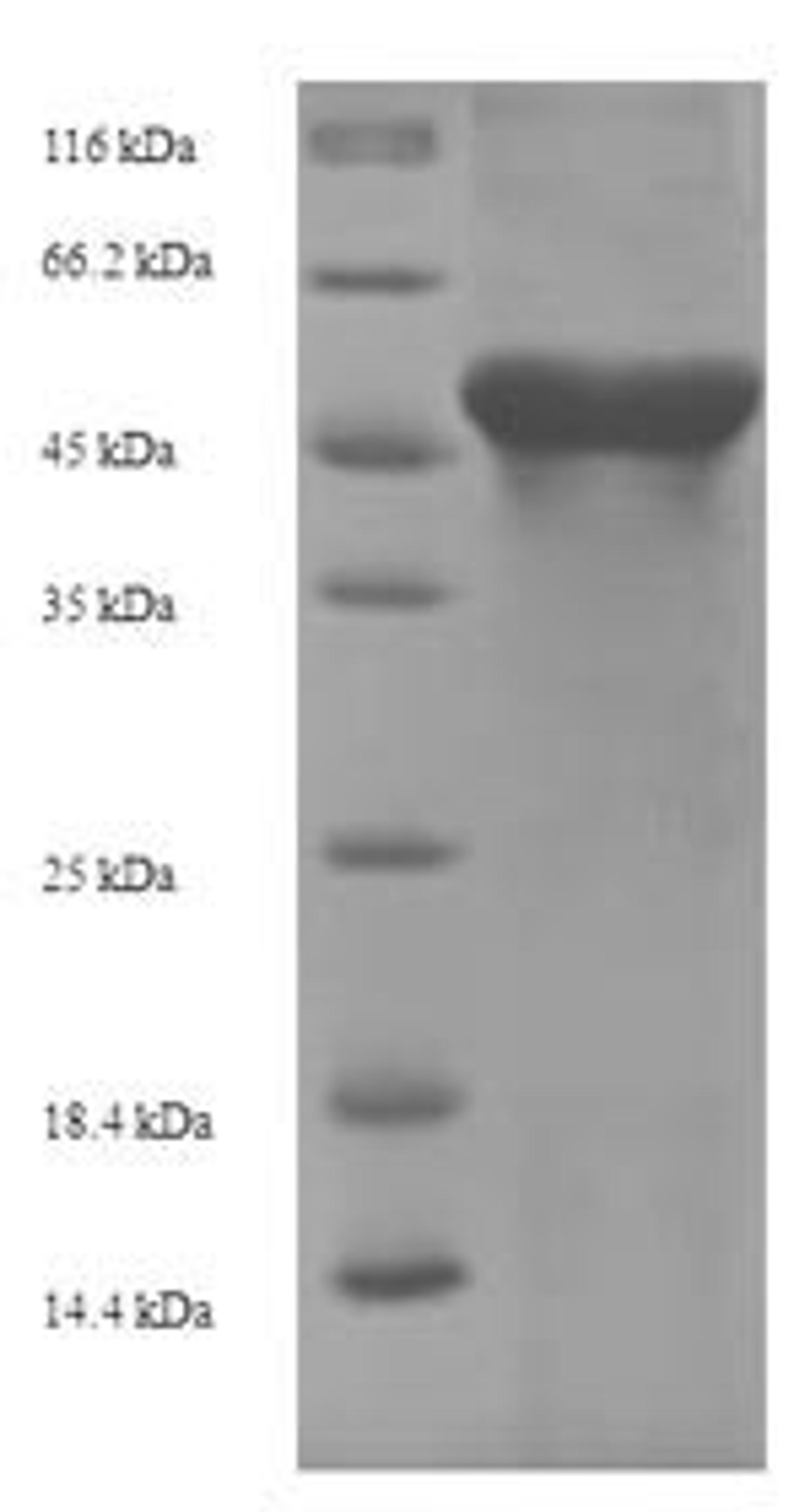(Tris-Glycine gel) Discontinuous SDS-PAGE (reduced) with 5% enrichment gel and 15% separation gel.