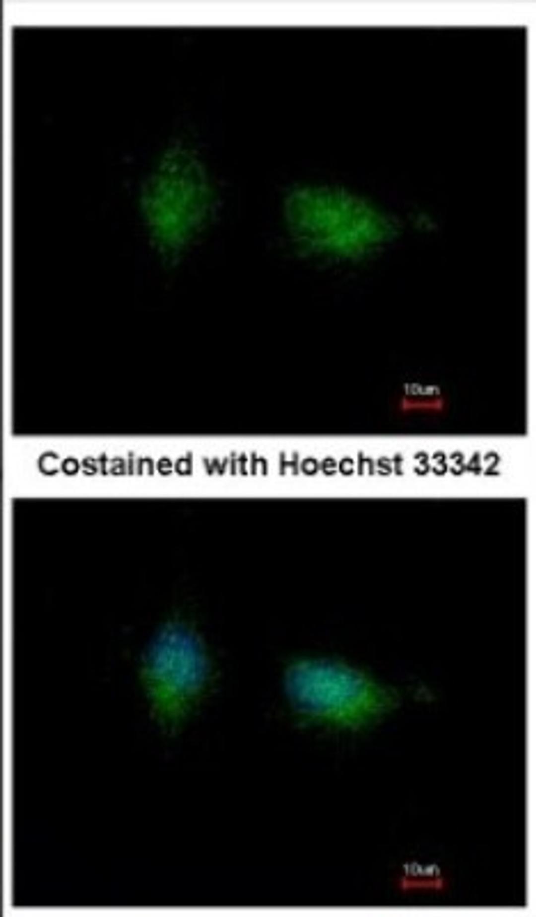 Immunocytochemistry/Immunofluorescence: PKC beta Antibody [NBP2-19846] - Immunofluorescence analysis of methanol-fixed HeLa, using antibody at 1:500 dilution.