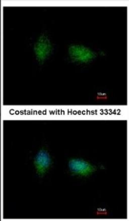 Immunocytochemistry/Immunofluorescence: PKC beta Antibody [NBP2-19846] - Immunofluorescence analysis of methanol-fixed HeLa, using antibody at 1:500 dilution.