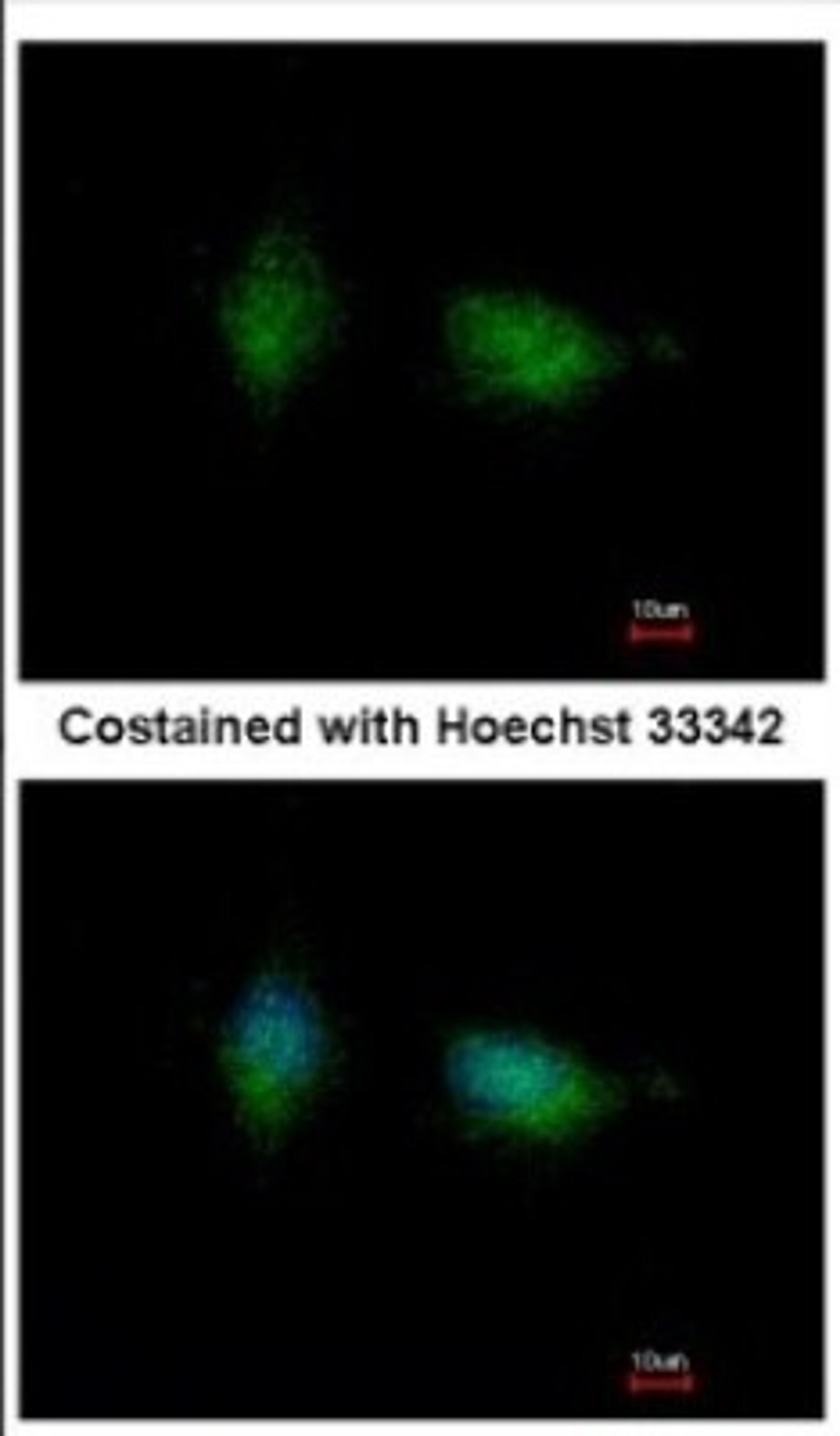 Immunocytochemistry/Immunofluorescence: PKC beta Antibody [NBP2-19846] - Immunofluorescence analysis of methanol-fixed HeLa, using antibody at 1:500 dilution.