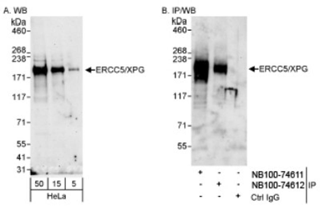 Western Blot: XPG Antibody [NB100-74611] - Detection of Human ERCC5/XPG on HeLa whole cell lysate using Nb100-74611. ERCC5/XPG was also immunoprecipitated by rabbit anti-ERCC5/XPG antibody NB100-74612.