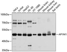 Western blot - AP1M1 antibody (A10129)