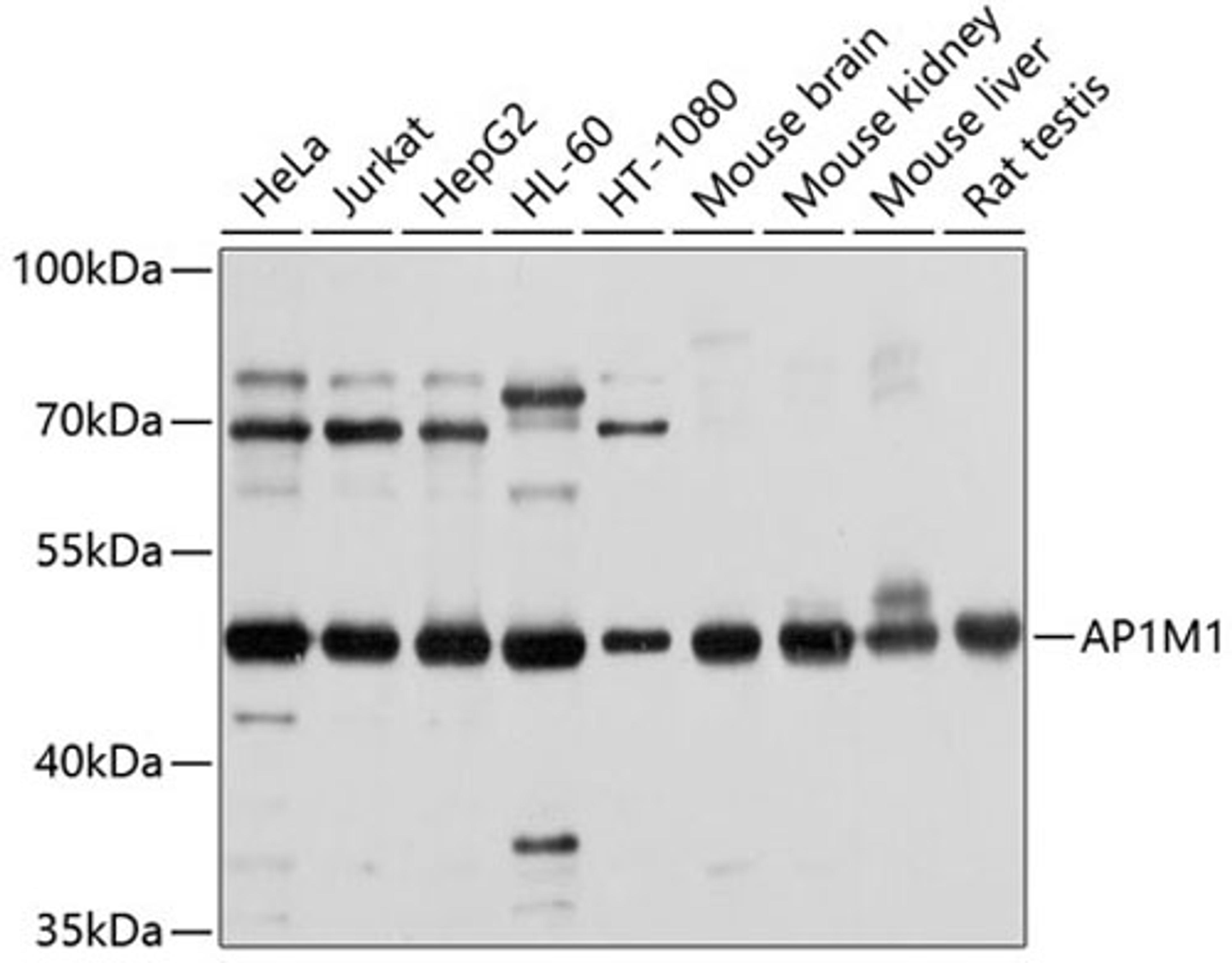 Western blot - AP1M1 antibody (A10129)