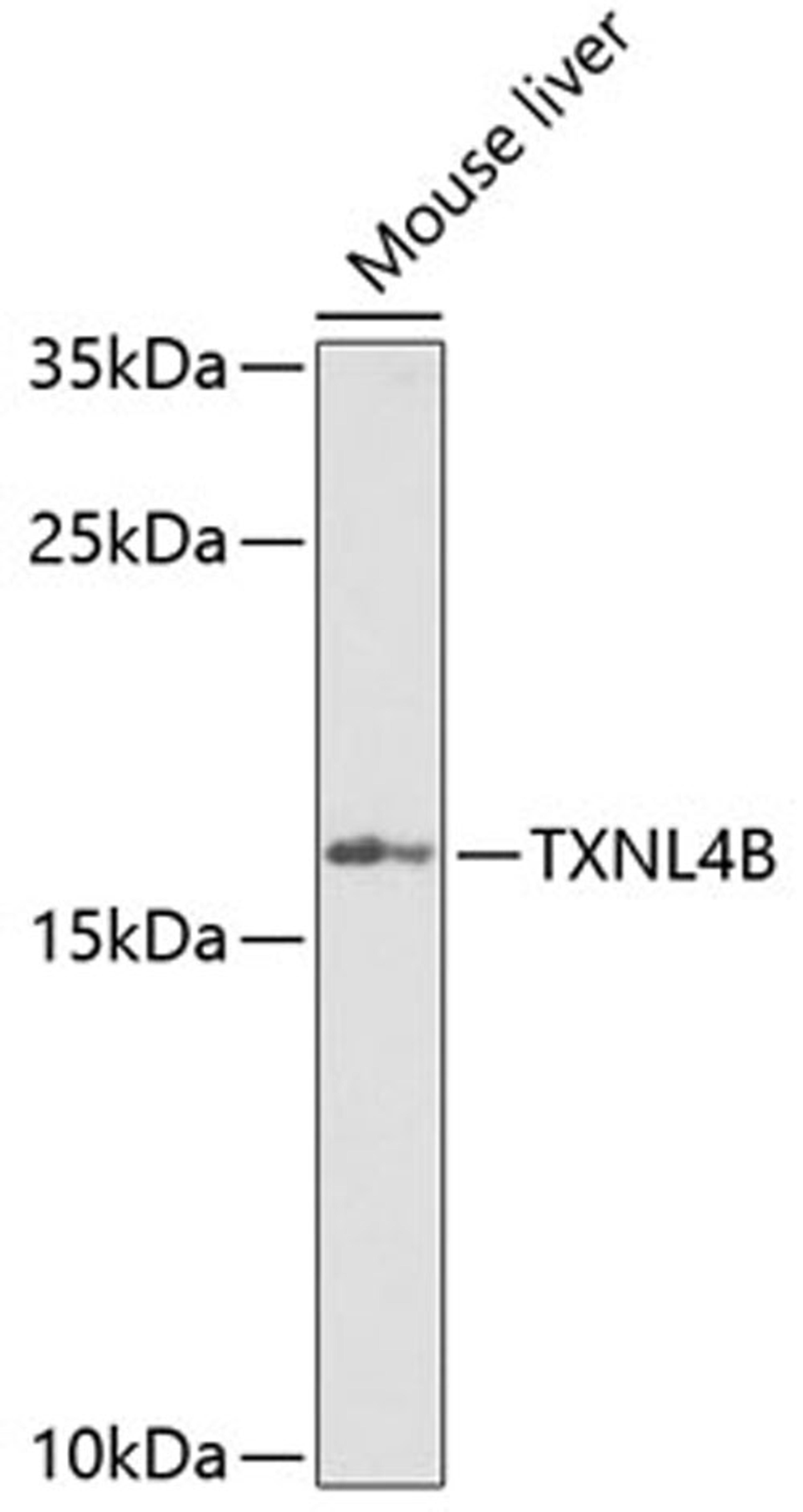 Western blot - TXNL4B Antibody (A7114)