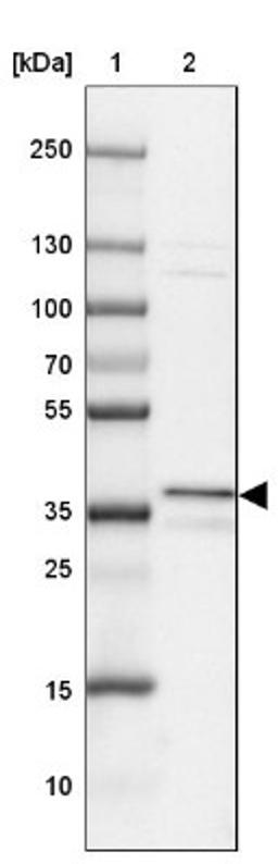 Western Blot: UNKL Antibody [NBP2-33766] - Lane 1: Marker [kDa] 250, 130, 100, 70, 55, 35, 25, 15, 10<br/>Lane 2: A-549