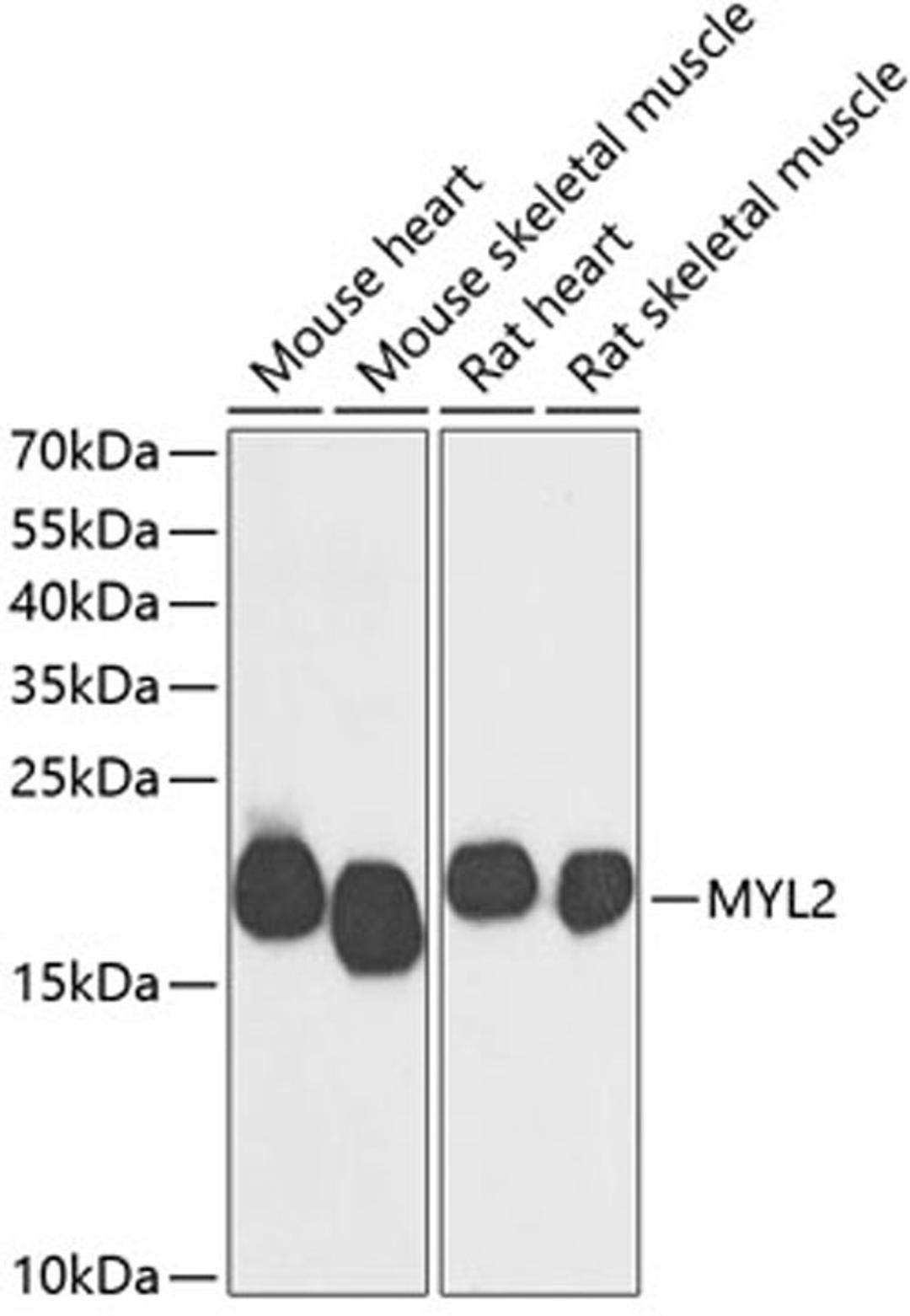 Western blot - MYL2 antibody (A14188)