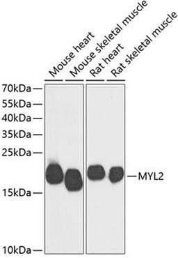 Western blot - MYL2 antibody (A14188)