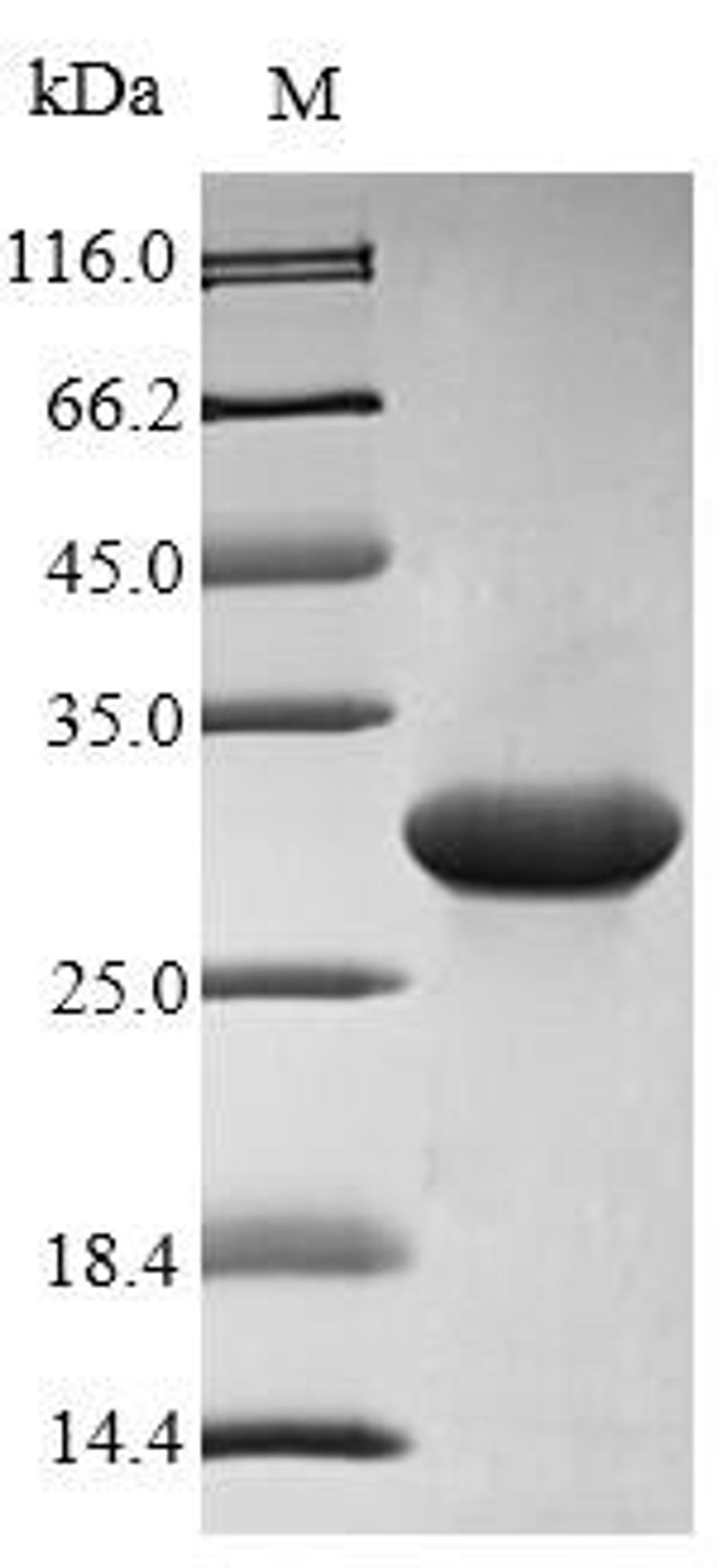 (Tris-Glycine gel) Discontinuous SDS-PAGE (reduced) with 5% enrichment gel and 15% separation gel.