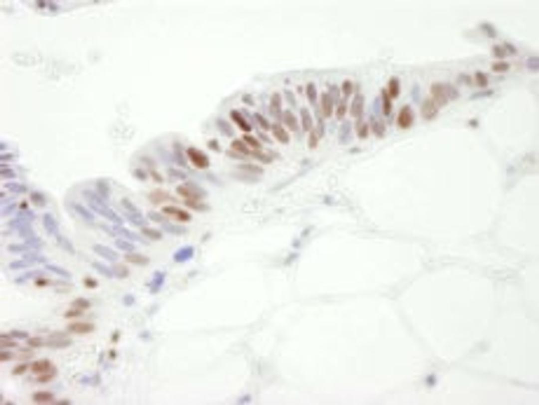 Detection of human MCM3 by immunohistochemistry.