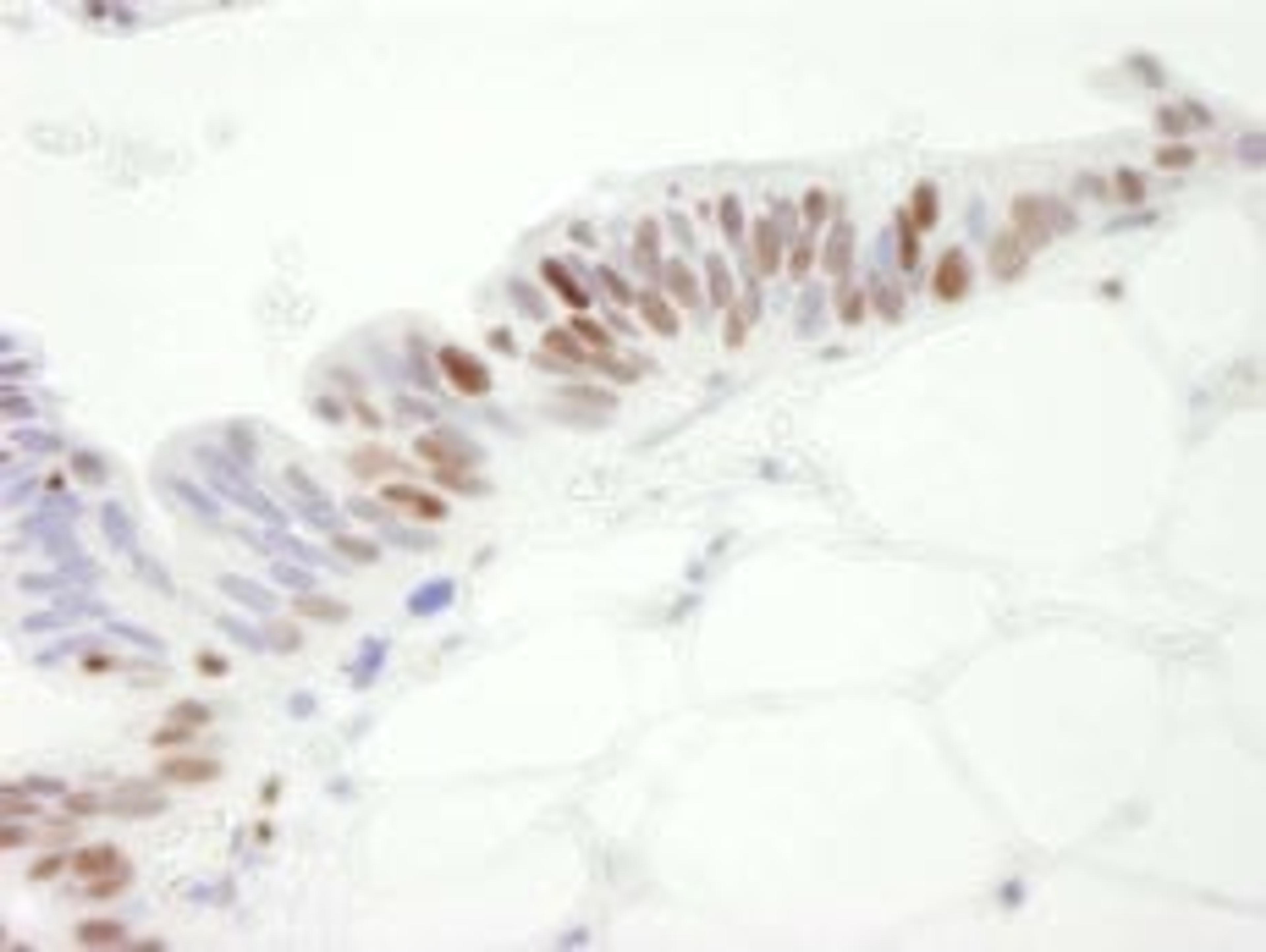 Detection of human MCM3 by immunohistochemistry.