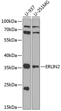 Western blot - ERLIN2 antibody (A8314)