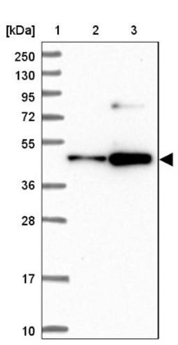 Western Blot: KLF5 Antibody [NBP1-88508] - Lane 1: Marker [kDa] 250, 130, 95, 72, 55, 36, 28, 17, 10<br/>Lane 2: Human cell line RT-4<br/>Lane 3: Human cell line U-251MG sp