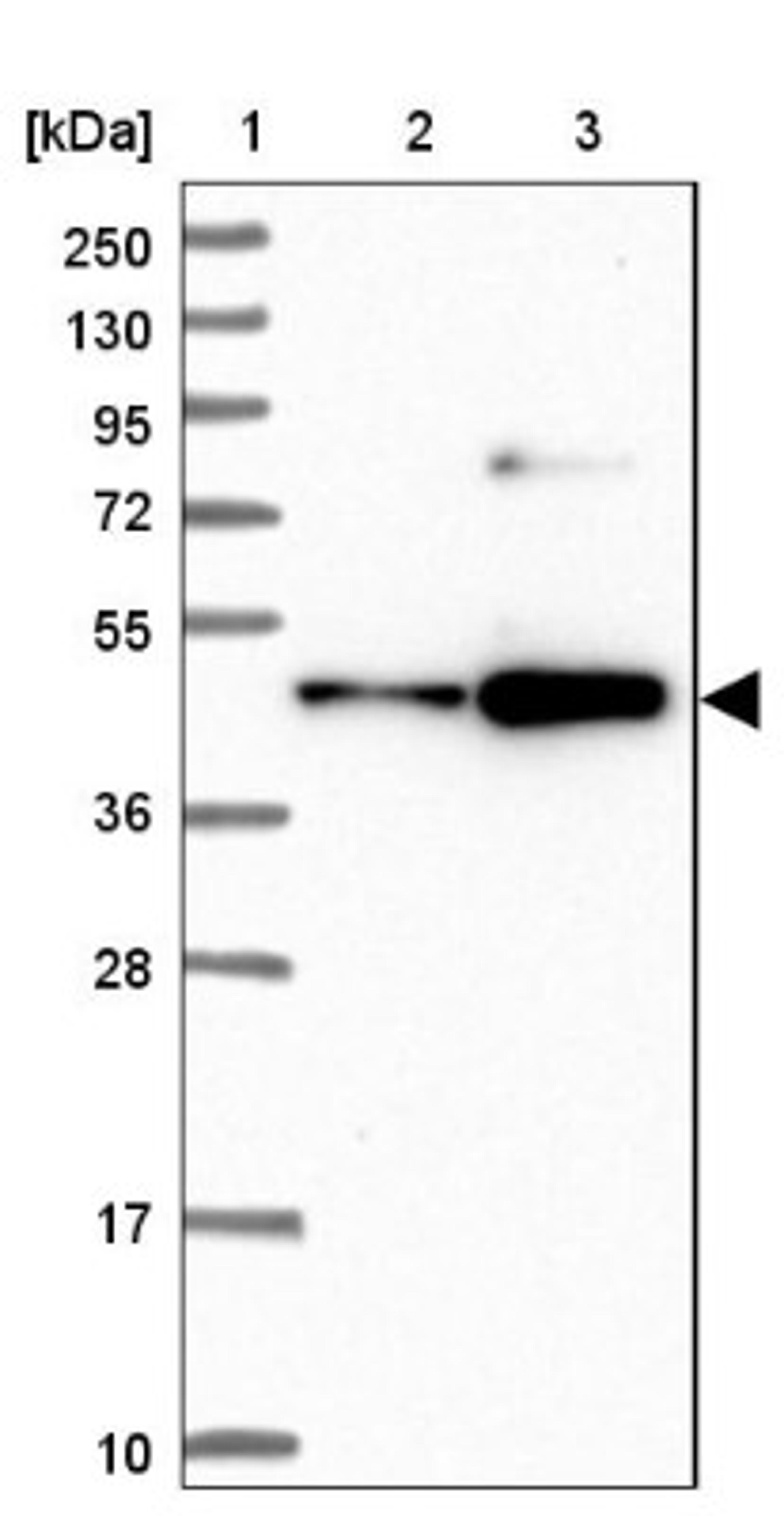 Western Blot: KLF5 Antibody [NBP1-88508] - Lane 1: Marker [kDa] 250, 130, 95, 72, 55, 36, 28, 17, 10<br/>Lane 2: Human cell line RT-4<br/>Lane 3: Human cell line U-251MG sp