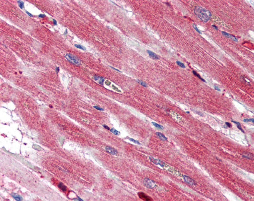 Immunohistochemistry staining of S100A4 in heart tissue using S100A4 Antibody.