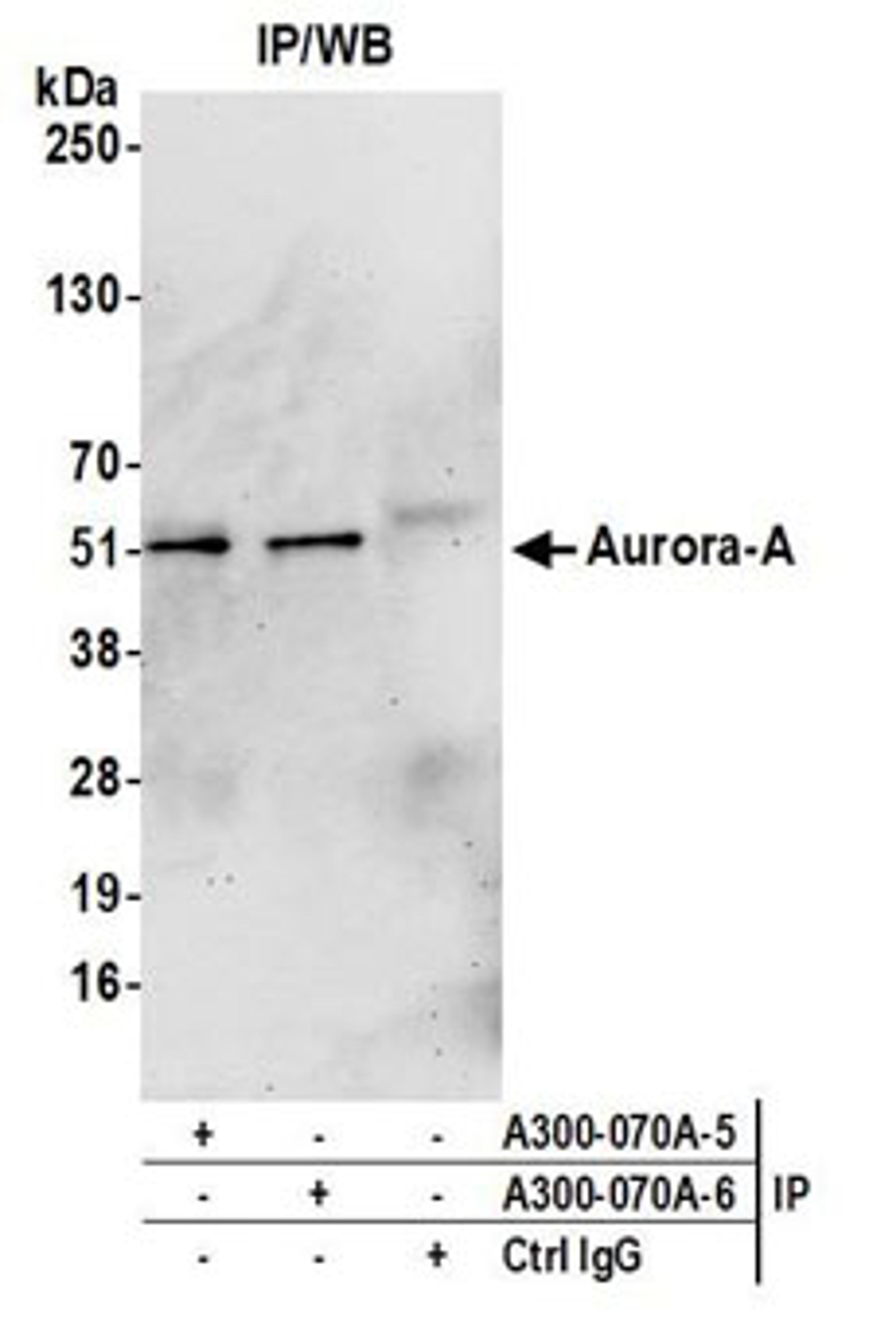 Detection of human Aurora A by western blot of immunoprecipitates.