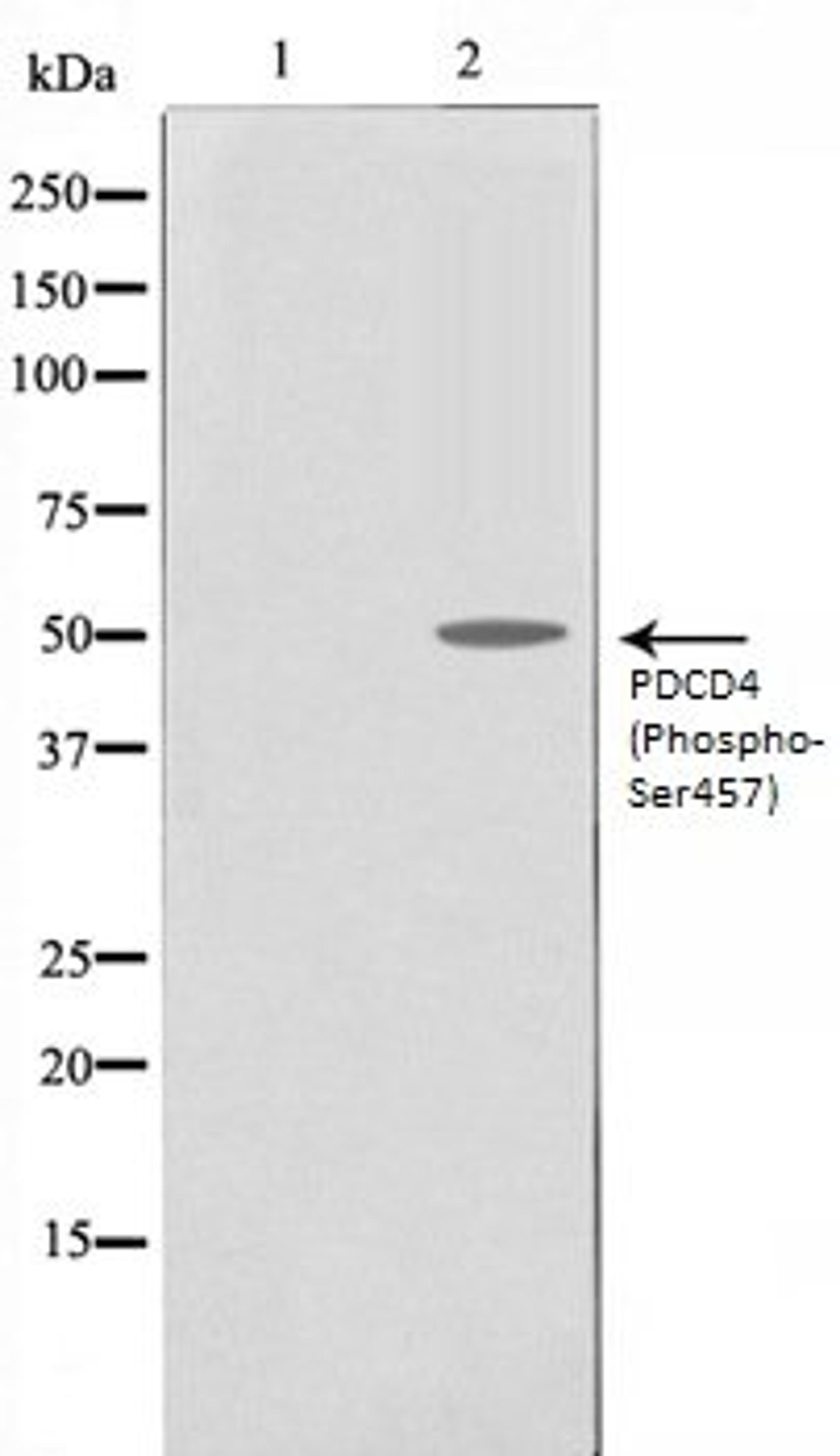 Western blot analysis of 293 whole cell lysates using PDCD4 (Phospho-Ser457) antibody, The lane on the left is treated with the antigen-specific peptide.