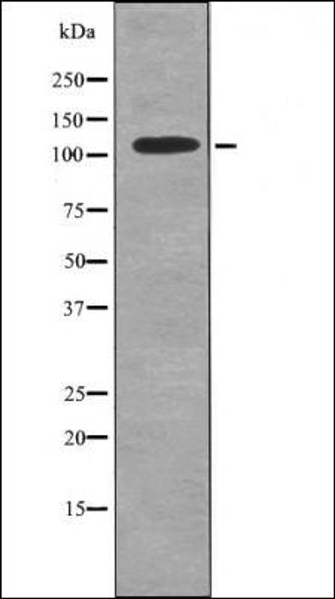 Western blot analysis of K562 whole cell lysates using TYRO3 -Phospho-Tyr753/Tyr685- antibody