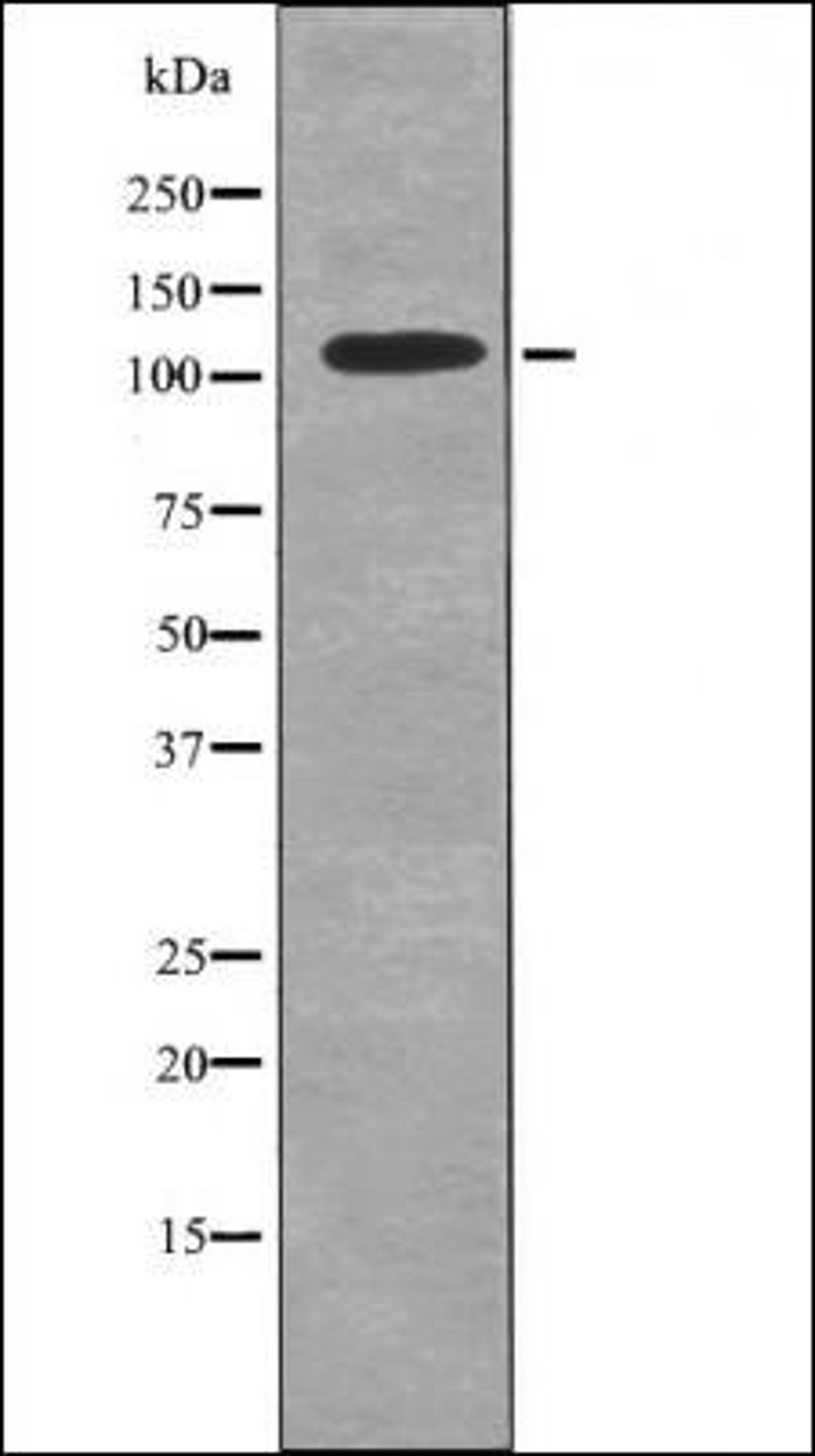 Western blot analysis of K562 whole cell lysates using TYRO3 -Phospho-Tyr753/Tyr685- antibody