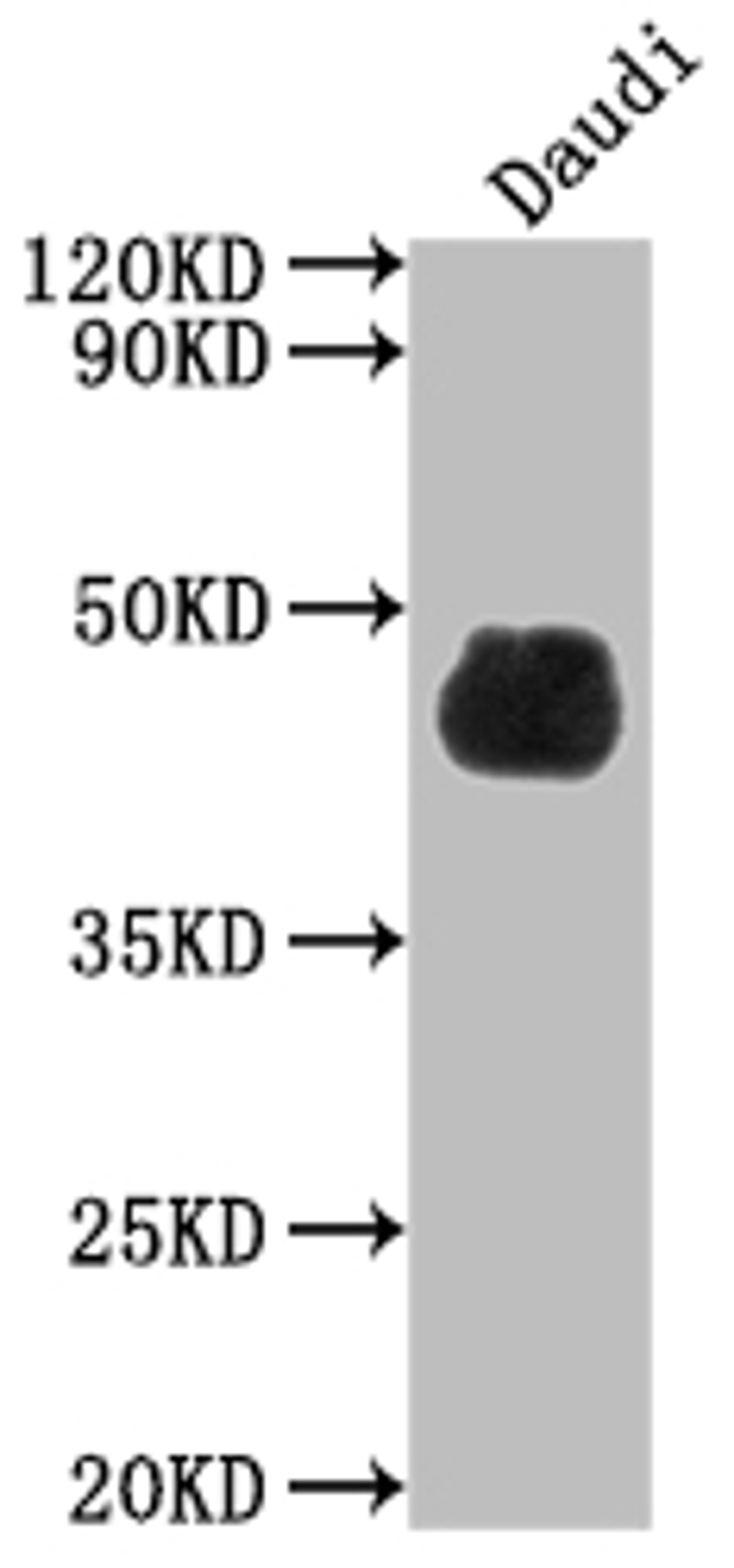 Western Blot. Positive WB detected in: Daudi whole cell lysate. All lanes: CD48 antibody at 1:2000. Secondary. Goat polyclonal to rabbit IgG at 1/50000 dilution. Predicted band size: 28, 20 kDa. Observed band size: 45 kDa. 