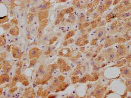 IHC image of CSB-RA921474A0HU diluted at 1:100 and staining in paraffin-embedded human liver tissue performed on a Leica BondTM system. After dewaxing and hydration, antigen retrieval was mediated by high pressure in a citrate buffer (pH 6.0). Section was blocked with 10% normal goat serum 30min at RT. Then primary antibody (1% BSA) was incubated at 4℃ overnight. The primary is detected by a Goat anti-rabbit IgG polymer labeled by HRP and visualized using 0.05% DAB.