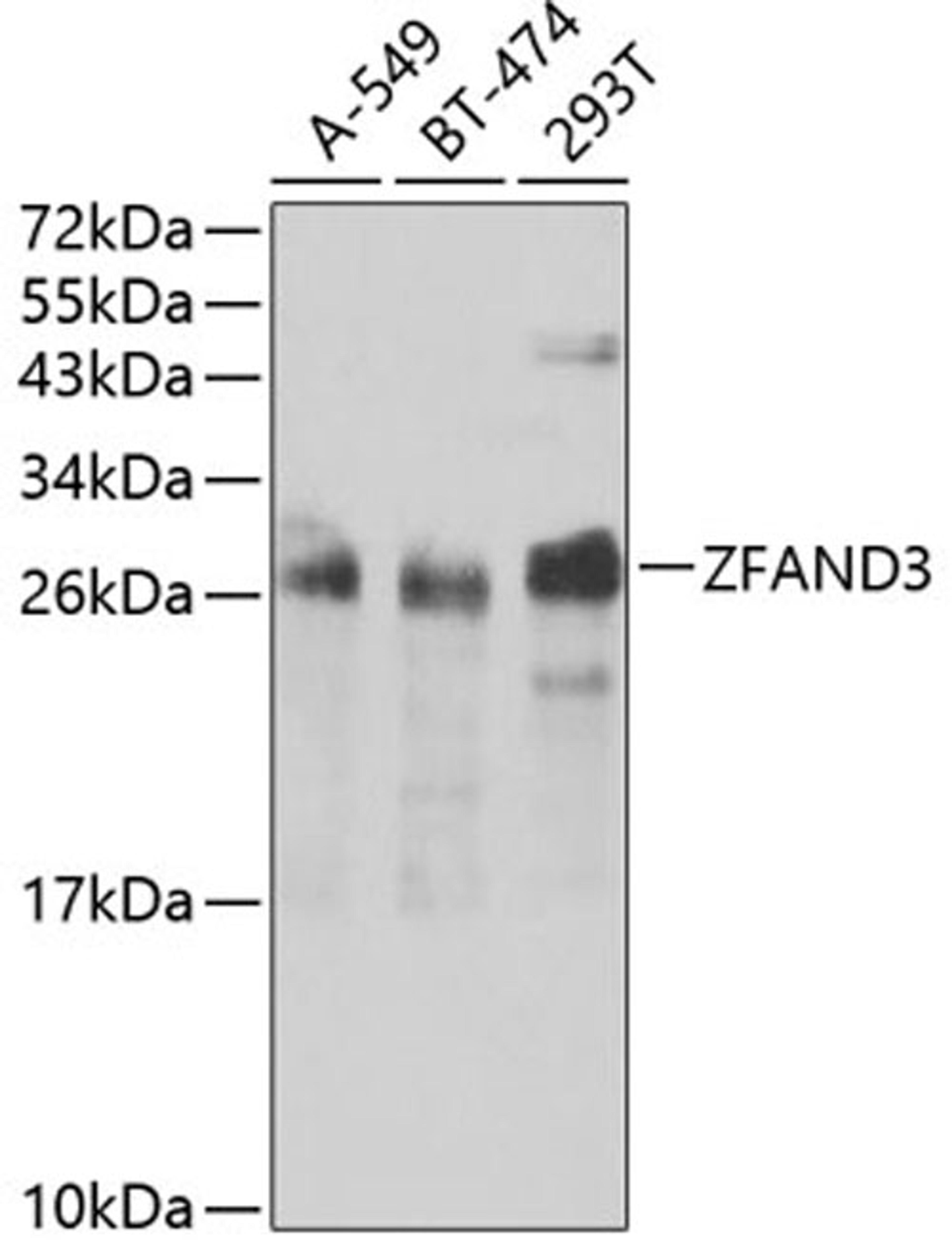 Western blot - ZFAND3 antibody (A7478)