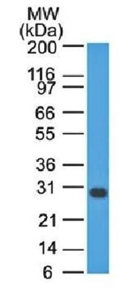 Western blot analysis of Jurkat cell lysate using BCL2L1 antibody