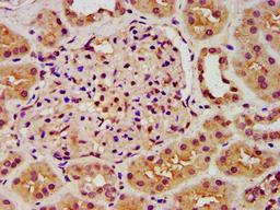 IHC image of CSB-PA619642LA01HU diluted at 1:300 and staining in paraffin-embedded human kidney tissue performed on a Leica BondTM system. After dewaxing and hydration, antigen retrieval was mediated by high pressure in a citrate buffer (pH 6.0). Section was blocked with 10% normal goat serum 30min at RT. Then primary antibody (1% BSA) was incubated at 4&deg;C overnight. The primary is detected by a biotinylated secondary antibody and visualized using an HRP conjugated SP system.