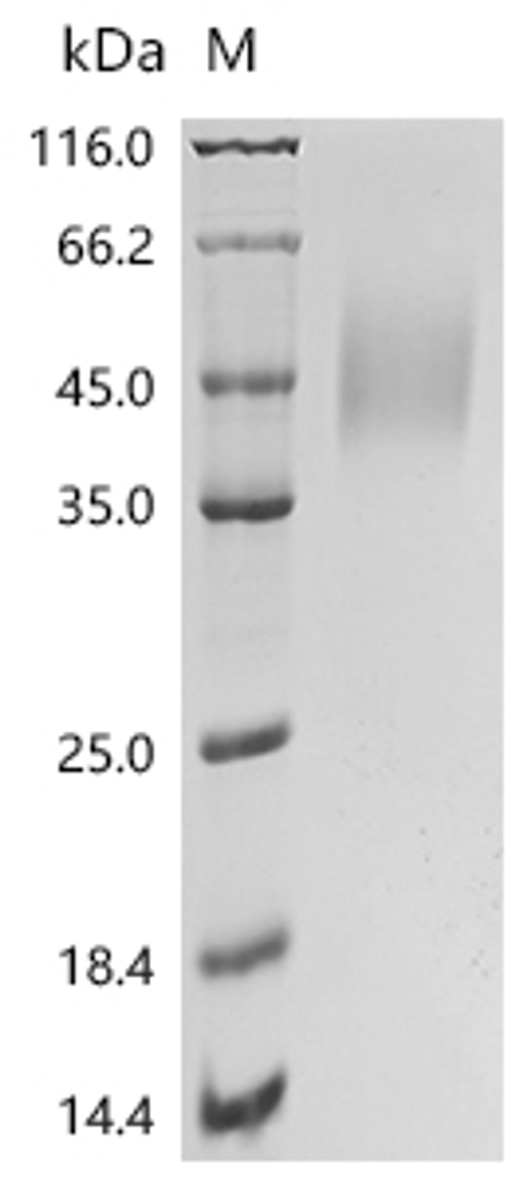 (Tris-Glycine gel) Discontinuous SDS-PAGE (reduced) with 5% enrichment gel and 15% separation gel.
