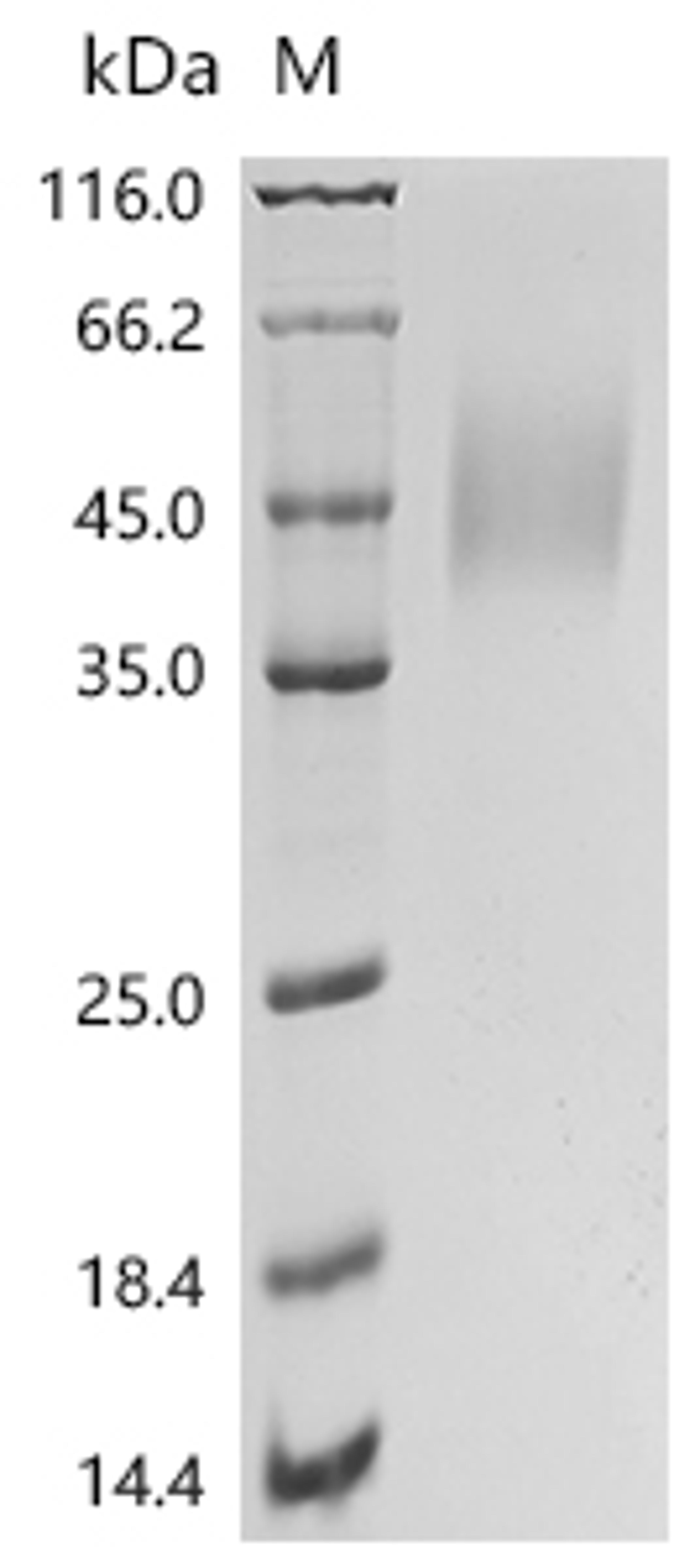 (Tris-Glycine gel) Discontinuous SDS-PAGE (reduced) with 5% enrichment gel and 15% separation gel.