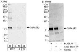 Detection of human CBFA2T2 by western blot and immunoprecipitation.