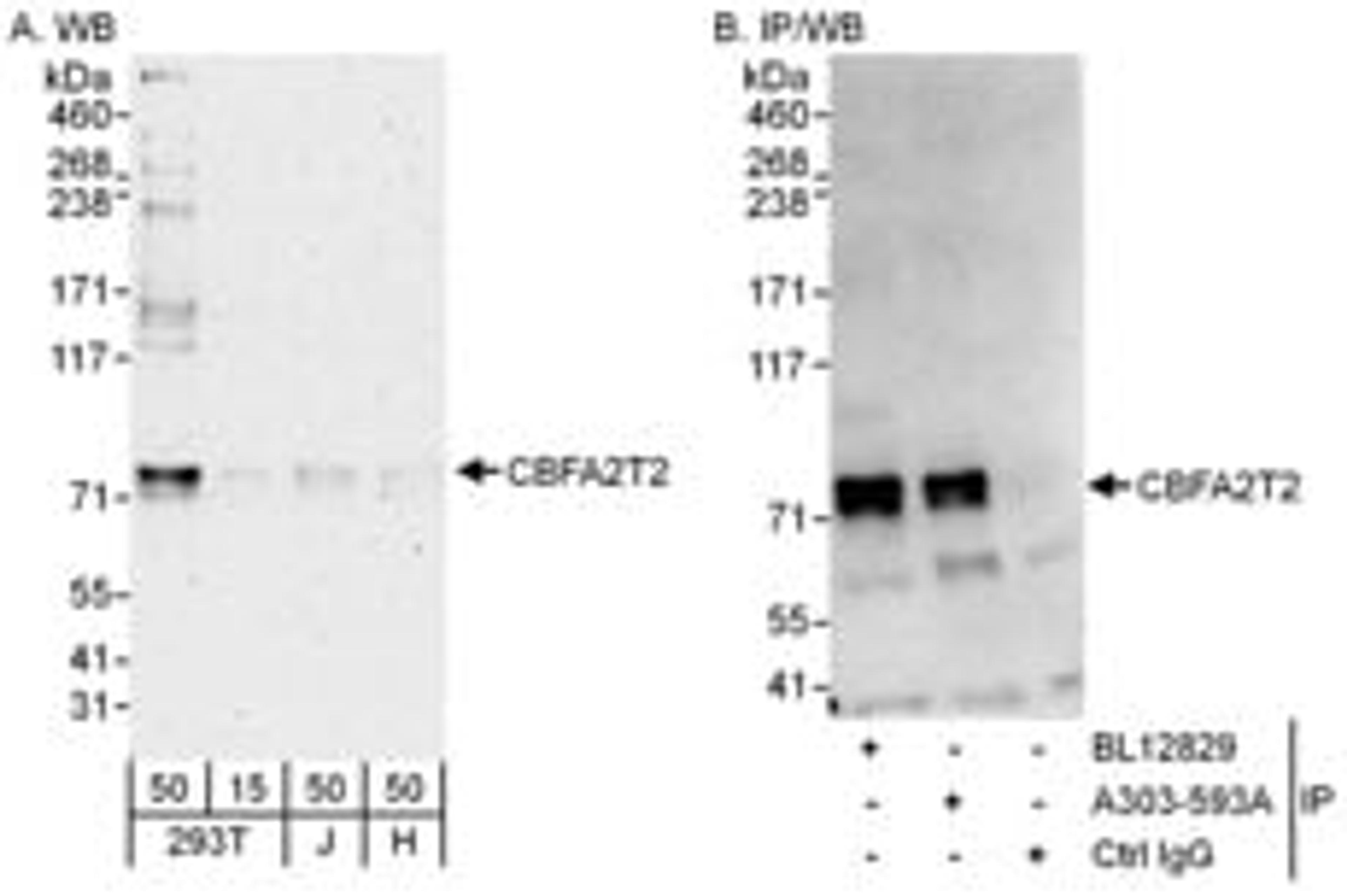 Detection of human CBFA2T2 by western blot and immunoprecipitation.