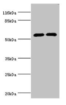 Western blot. All lanes: CYP2E1 antibody at 12µg/ml. Lane 1: Jurkat whole cell lysate. Lane 2: Mouse liver tissue. Secondary. Goat polyclonal to rabbit IgG at 1/10000 dilution. Predicted band size: 57 kDa. Observed band size: 57 kDa