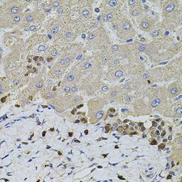 Immunohistochemistry  - S100A12 antibody (A5328)