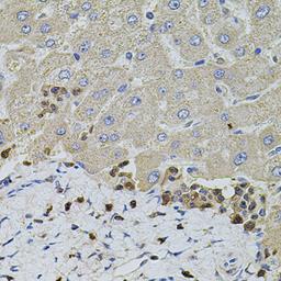 Immunohistochemistry - S100A12 antibody (A5328)