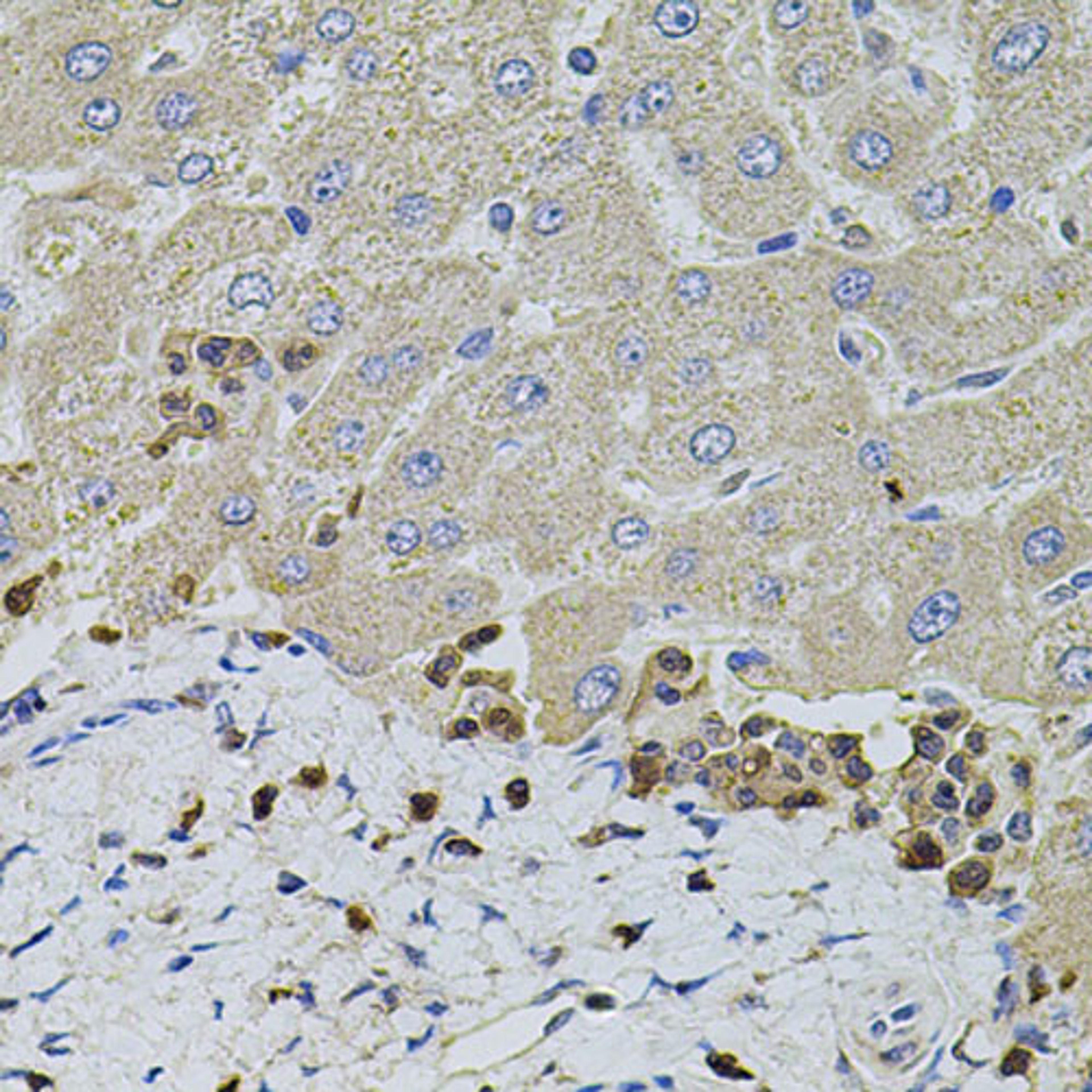 Immunohistochemistry - S100A12 antibody (A5328)
