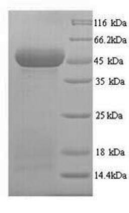 (Tris-Glycine gel) Discontinuous SDS-PAGE (reduced) with 5% enrichment gel and 15% separation gel.