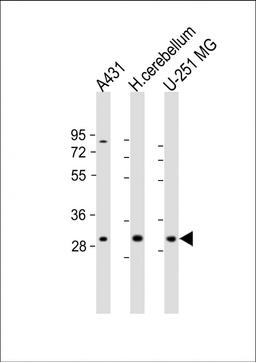 Western Blot at 1:1000-2000 dilution Lane 1: A431 whole cell lysate Lane 2: human cerebellum lysate Lane 3: U-251 MG whole cell lysate Lysates/proteins at 20 ug per lane.