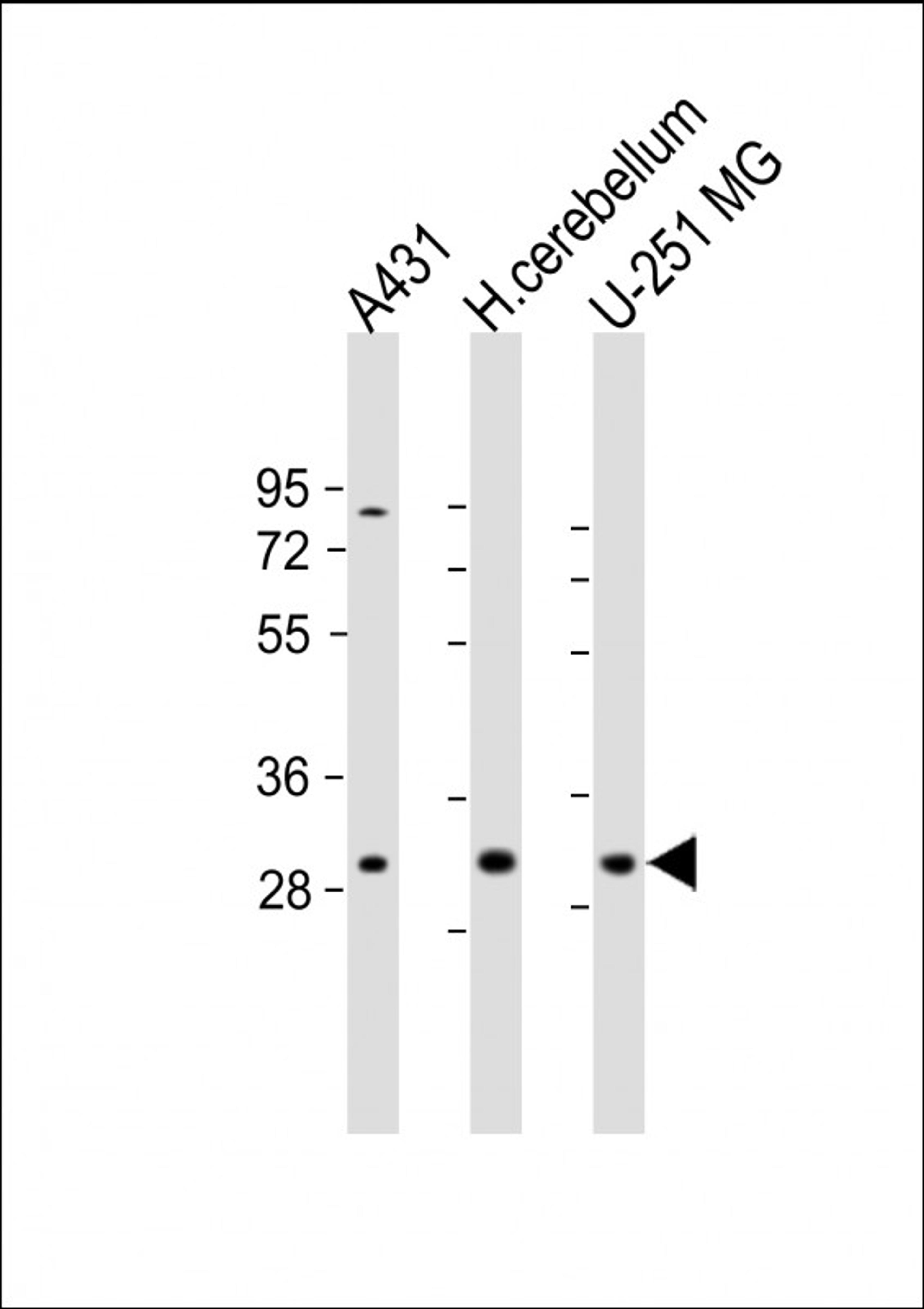 Western Blot at 1:1000-2000 dilution Lane 1: A431 whole cell lysate Lane 2: human cerebellum lysate Lane 3: U-251 MG whole cell lysate Lysates/proteins at 20 ug per lane.