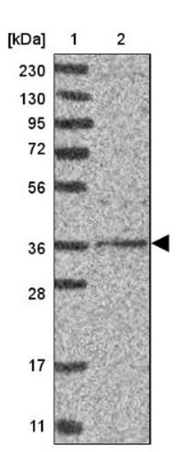 Western Blot: DSCC1 Antibody [NBP2-33275] - Lane 1: Marker [kDa] 230, 130, 95, 72, 56, 36, 28, 17, 11<br/>Lane 2: Human cell line RT-4